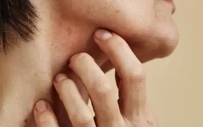 Psoriasis Schuppenflechte und Ayrveda Banner