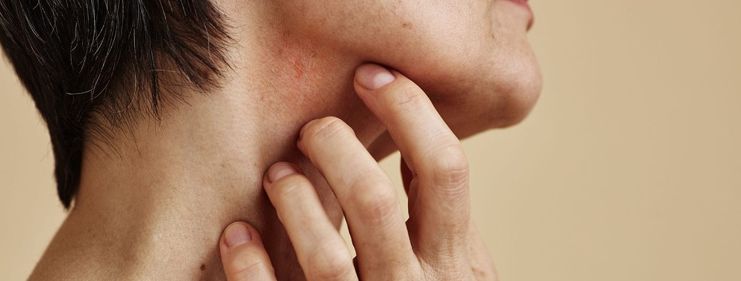 Psoriasis Schuppenflechte und Ayrveda Banner